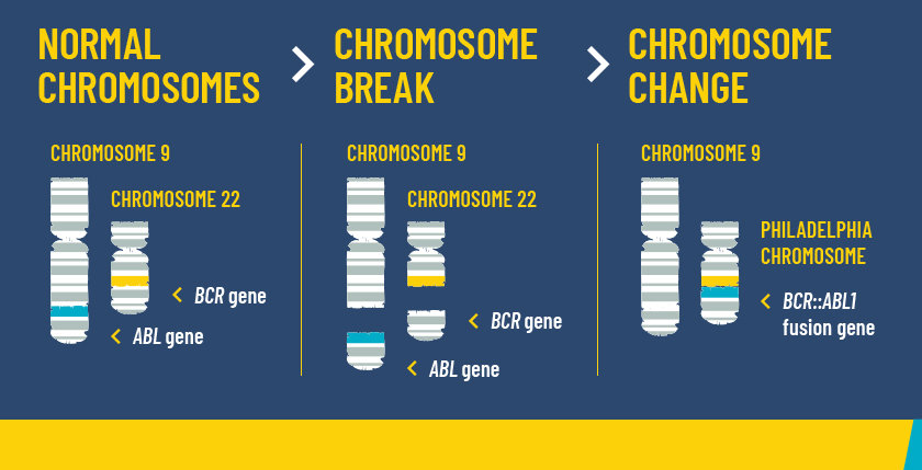 image showing how  a normal chromosome impacted by Ph+ CML break and change in the body